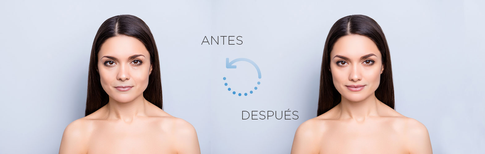 Antes / Después